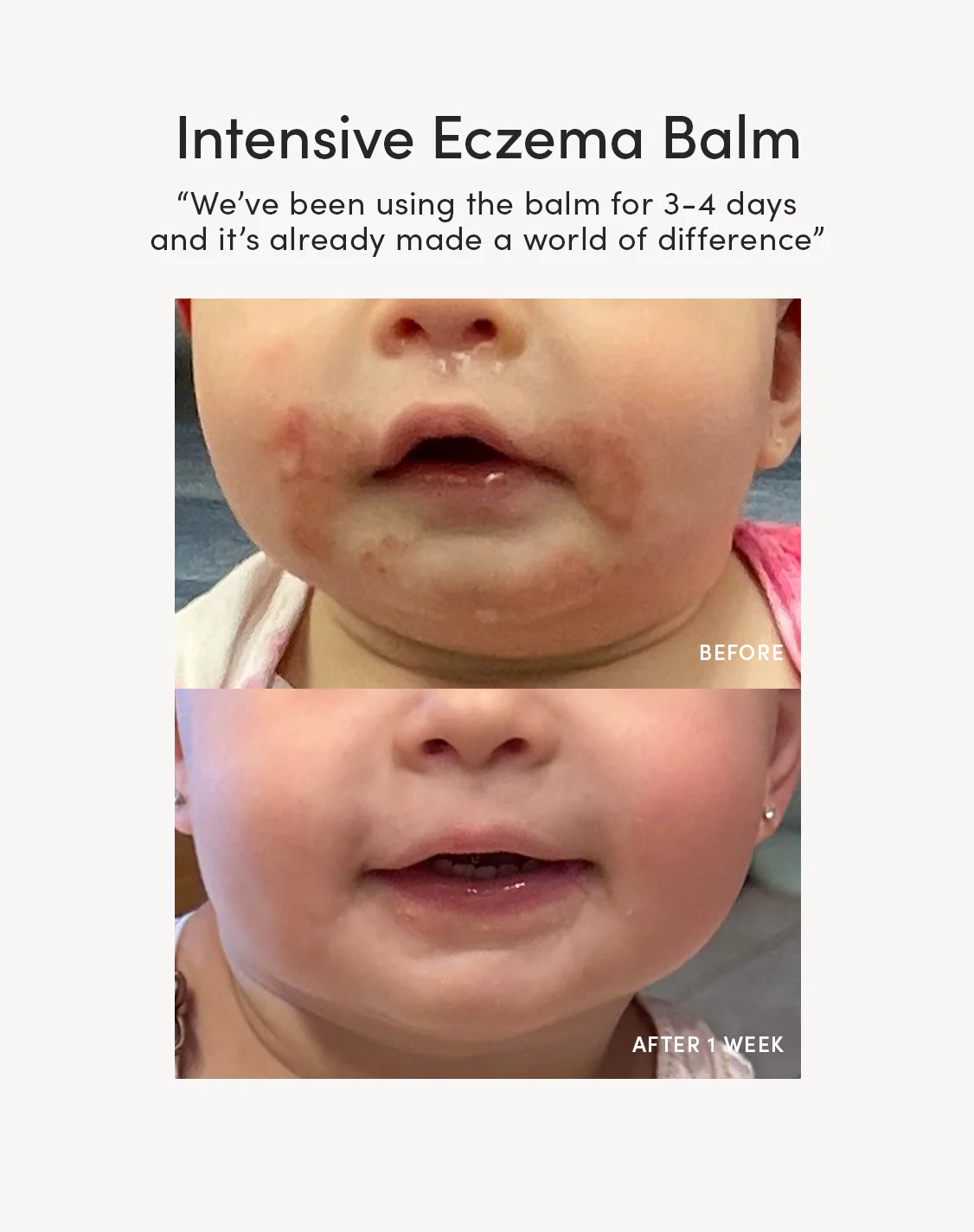 Intensive Eczema Balm - Image 7